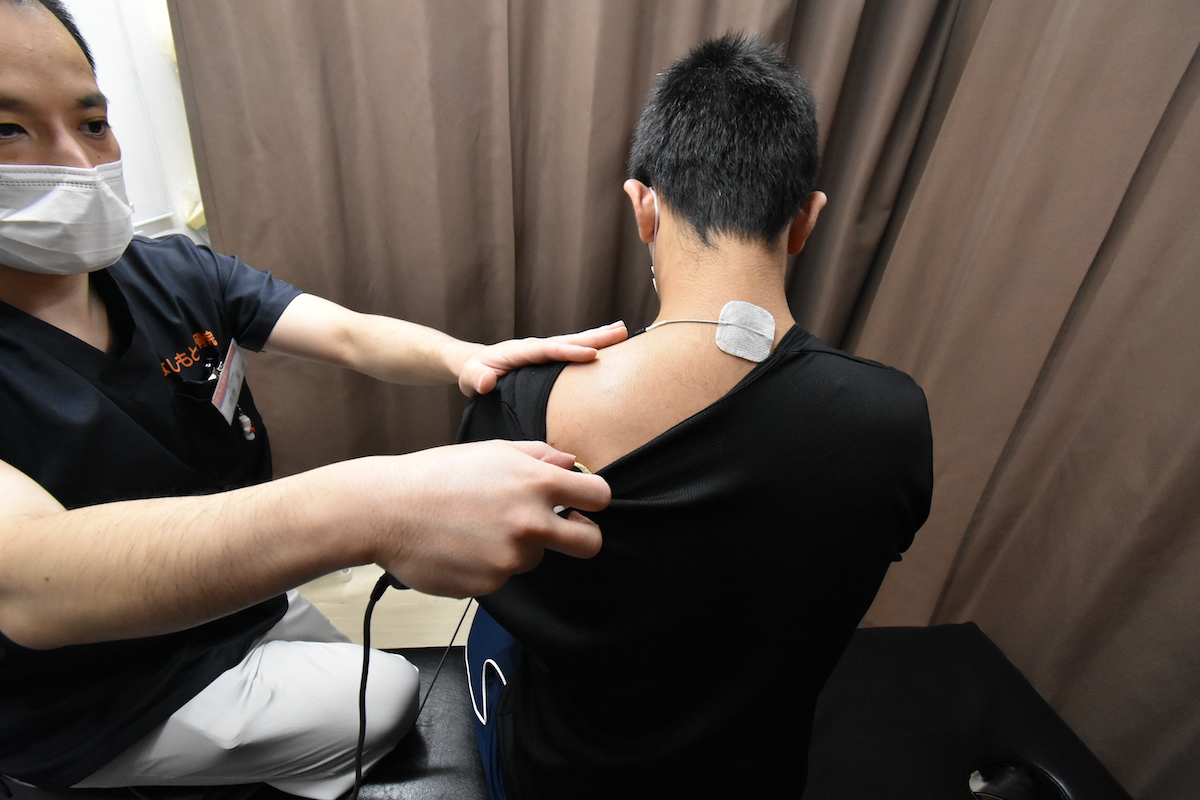 四十肩/五十肩施術写真