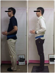 仕事もできないほどの腰痛。一回で痛みはほぼなし！原因のわからない痛み。ギックリ腰。インナーマッスルが原因です！