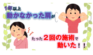 1年以上動かない肩の悩みが解消されたお話