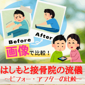 “ビフォー・アフター”の比較