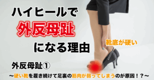 外反母趾① 〜硬い靴を履き続けて足裏の筋肉が弱ってしまうのが原因！？〜