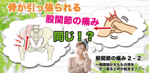 股関節の痛み２−２ 〜腸腰筋が太ももの骨を引っ張ると何が起きる？？〜